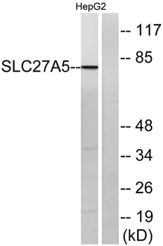 ACSVL6 antibody