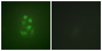KIF2C (phospho Ser95) rabbit pAb