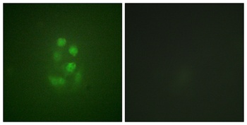 KIF2C (phospho-Ser95) antibody