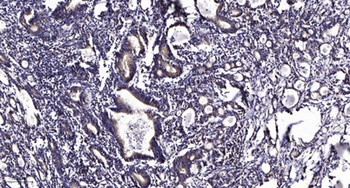 KIF2C (phospho Ser95) rabbit pAb