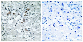 KDEL Receptor 3 rabbit pAb