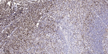 Stonin-1 antibody