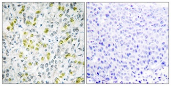 Mi2-beta antibody