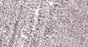 Chk1 (phospho Ser317) rabbit pAb