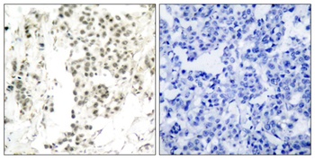 Chk1 (phospho-Ser345) antibody