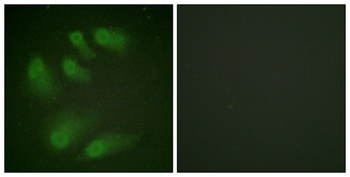 Chk1 (phospho Ser286) rabbit pAb