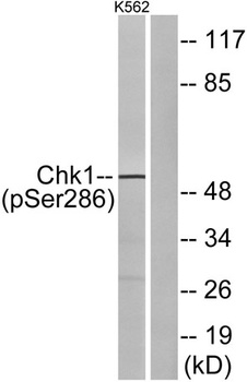 Chk1 (phospho-Ser286) antibody