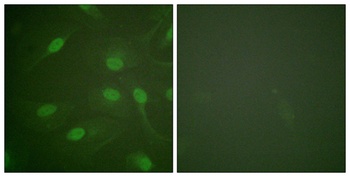 Chk1 (phospho Ser301) rabbit pAb