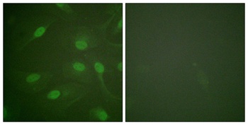 Chk1 (phospho-Ser301) antibody