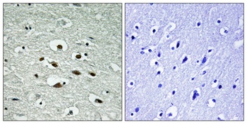 Chk1 (phospho Ser296) rabbit pAb