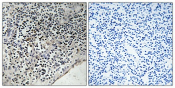 Cdc37 (phospho Ser13) rabbit pAb