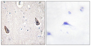 A Cyclase V/VI antibody