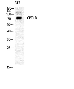 CPTI-M antibody