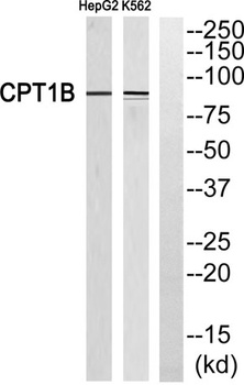 CPTI-M antibody