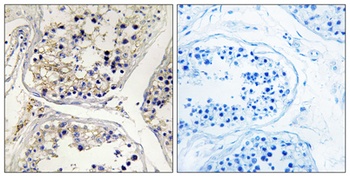 CPTI-M antibody