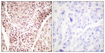 Chk2 (phospho Thr387) rabbit pAb
