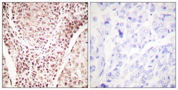 Chk2 (phospho-Thr387) antibody