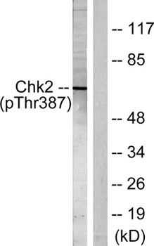 Chk2 (phospho Thr387) rabbit pAb