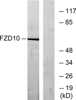 Frizzled-10 rabbit pAb