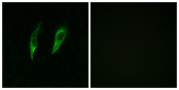 IRAK-M antibody