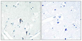 IRAK-M antibody