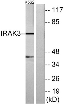 IRAK-M antibody