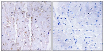 AKAP 13 rabbit pAb Antibody
