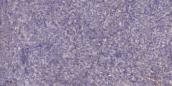 AKAP 10 antibody