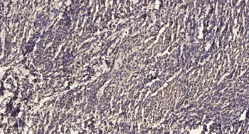 MKP-5 antibody