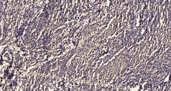 MKP-5 rabbit pAb