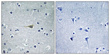 CA VB antibody