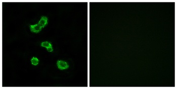 CA VB antibody