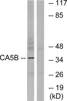 CA VB rabbit pAb