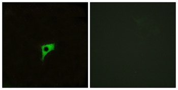 mAChR M2 antibody