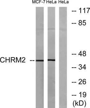 mAChR M2 antibody