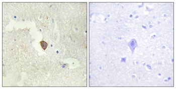 A Cyclase VII antibody