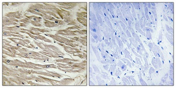 TUSC2 antibody