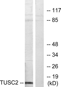 TUSC2 antibody