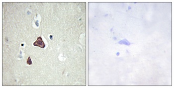 A Cyclase VIII rabbit pAb