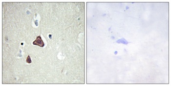 A Cyclase VIII antibody