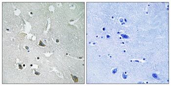 TIRAP (phospho-Tyr86) antibody