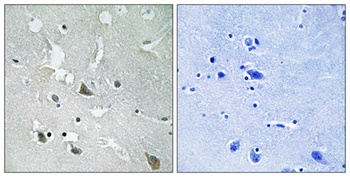 TIRAP (phospho Tyr86) rabbit pAb