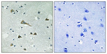 TIRAP rabbit pAb Antibody