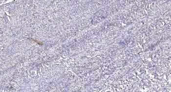 Rhophilin rabbit pAb