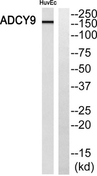 A Cyclase IX antibody