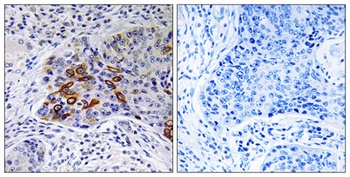 A Cyclase IX antibody