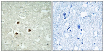 RAB3IP antibody