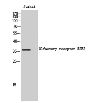 Olfactory receptor 52E2 rabbit pAb