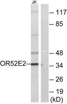 Olfactory receptor 52E2 antibody