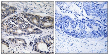 CYP2R1 antibody